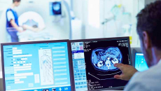 Doctor looking at radiation images