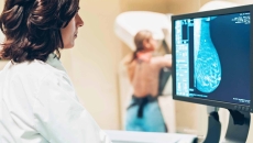 Mammography exam