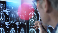 GenAI adoption grows, but concerns over accuracy dominate