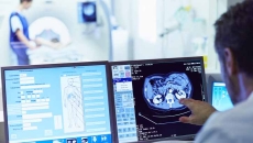 Doctor looking at radiation images