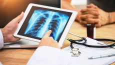 X-Ray