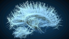 Imaging of the human brain