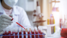 Blood samples prepared in a laboratory