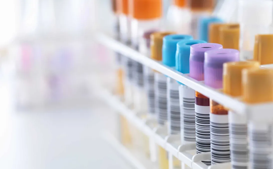 Lab test tubes
